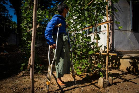 ရှမ်းပြည်မြောက်ပိုင်း နမ့်ပန်ရွာမှ မြေမြှုပ်မိုင်းပေါက်ကွဲမှုကြောင့် ခြေထောက်တစ်ဖက်ဖြတ်လိုက်ရသည့် အသက် ၁၄ နှစ်အရွယ် လူငယ်တစ်ဦးကို တွေ့ရစဉ်  